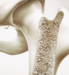 בריחת סידן? כך תשמרו על משק העצם כבר מגיל צעיר-תמונה